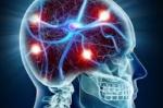 Stress Hormones